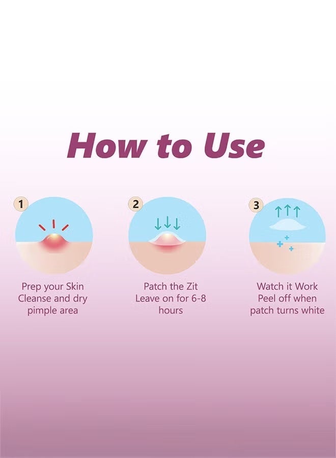 Floren Amazing Overnight Acne Patch | 28 Patches, 3 Sizes (8mm, 10mm, and 12mm) | Thick Hydrocolloid Acne Patch | More Effective with Extra Adhesion for Wound/Acne Healing | Acne Patch Stickers | South Korean Skincare | Drug-Free - Image 3